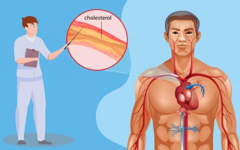 Cholesterol Levels